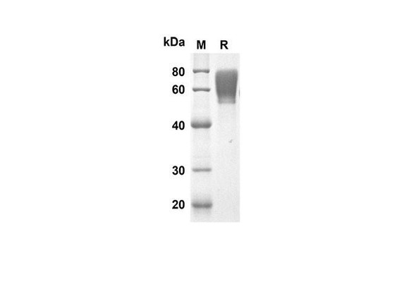 Recombinant Rat CD48 Protein (Fc Tag) (RPES8521)