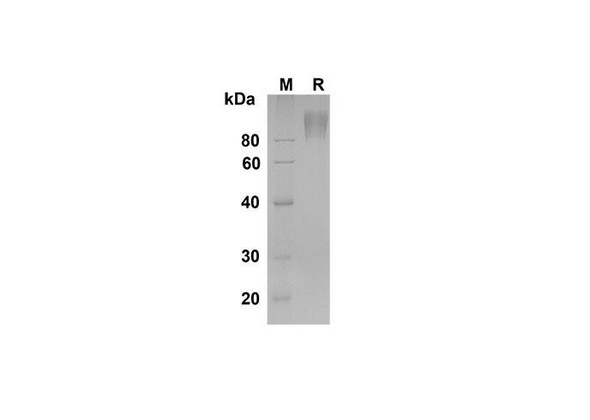 Recombinant Rat CEACAM-1/CD66a Protein (Fc Tag) (RPES8532)