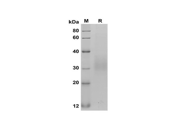 Recombinant Rat Fas/TNFRSF6/CD95 Protein (His Tag) (RPES8540)
