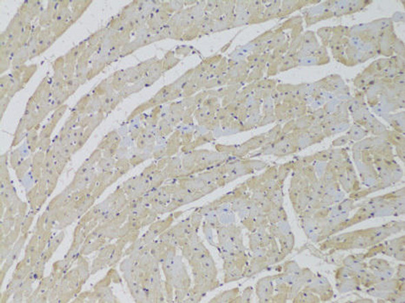 Anti-SCARB2 Antibody (CAB6285)