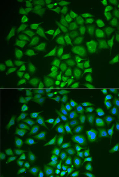 Anti-PNOC Antibody (CAB6395)