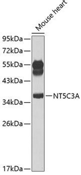 Anti-NT5C3A Antibody (CAB7593)
