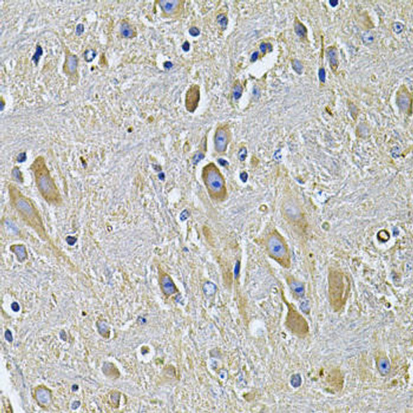 Anti-PLCG1 Antibody (CAB7711)