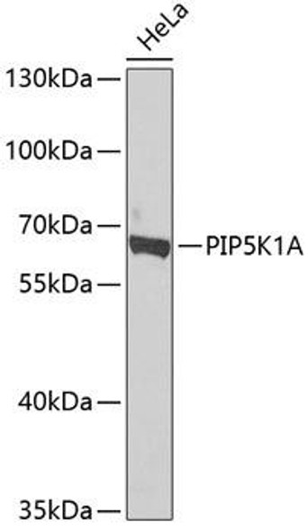 Anti-PIP5K1A Antibody (CAB7941)