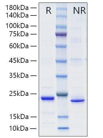 Recombinant Mouse TNFSF15/TL1A Protein (RPCB0013)