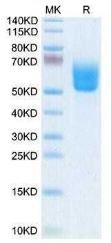 Biotinylated Recombinant Human Dkk-3 Protein (RPCB0045)
