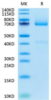 Biotinylated Recombinant Human Glypican-3/GPC3 Protein (RPCB0050)