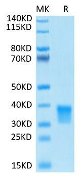 Biotinylated Recombinant Human Oncostatin-M/OSM Protein (RPCB0062)