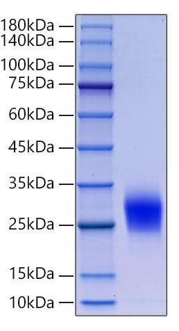 Recombinant Human Thy-1/CD90 Protein (RPCB0086)