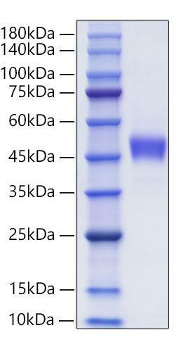 Recombinant Human CXC-chemokine receptor 1/CXCR1 Protein (RPCB0107)