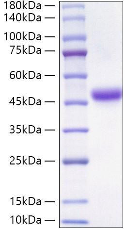 Recombinant Human Neutrophil cytosol factor 1/NCF1 Protein (RPCB0130)