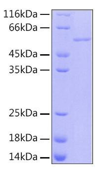 Recombinant Human RBBP-4 Protein (RPCB0165)