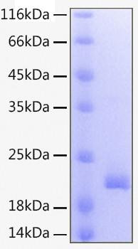 Recombinant Human TNFSF9/4-1BB Ligand Protein (RPCB0166)
