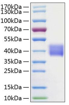 Recombinant Human Kallikrein-1/KLK1 Protein (RPCB0173)