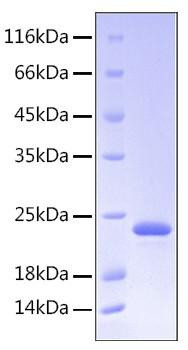 Recombinant Human Somatotropin/GH-N/GH1 Protein (RPCB0180)