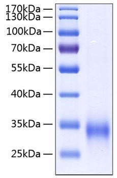 Recombinant Human MBP-C/MBL-2 Protein (RPCB0193)