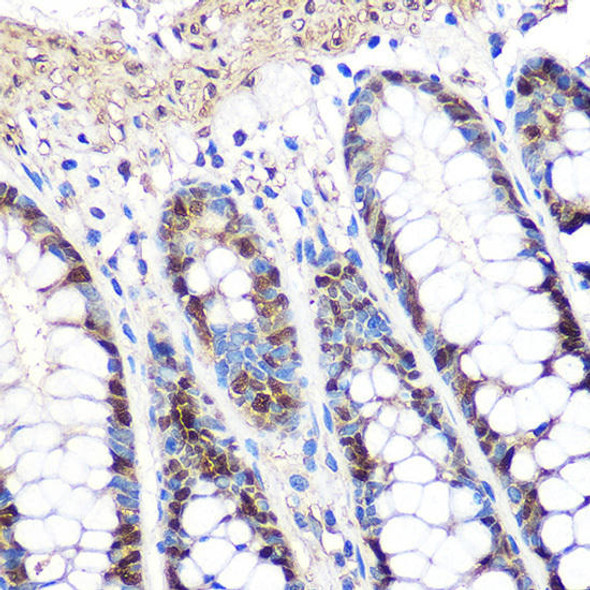 Anti-PCNA Monoclonal Antibody (CAB9909)