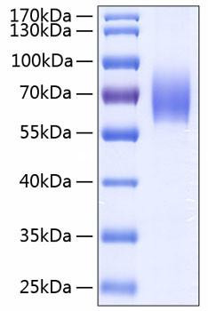 Recombinant Human IL-18BP Protein (RPCB0240)