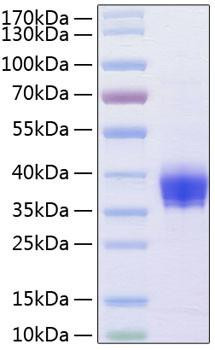 Recombinant Human Ep-CAM/TROP-1/CD326 Protein (RPCB0244)