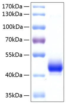 Recombinant Human ALK-4/ACVR1B Protein (RPCB0245)