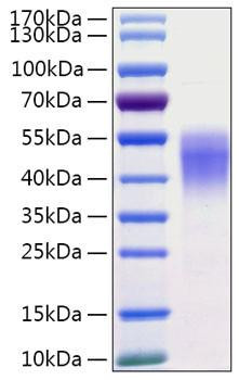 Recombinant Human CD38 Protein (RPCB0248)