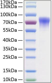 Recombinant Human GDNFR-alpha-2/GFRA2 Protein (RPCB0257)