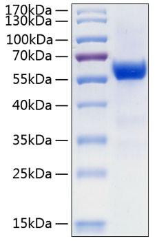 Recombinant Human Frizzled-7/FZD7 Protein (RPCB0261)