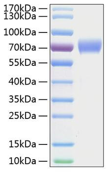 Recombinant Human Tyrosine-protein kinase receptor UFO/Axl Protein (RPCB0276)