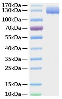 Recombinant Human Aminopeptidase N/APN/CD13 Protein (RPCB0278)