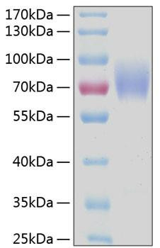 Recombinant Human FCAR/CD89 Protein (RPCB0279)