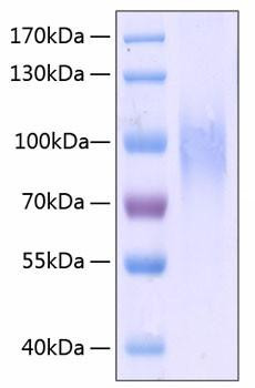 Recombinant Human PECAM-1/CD31 Protein (RPCB0284)