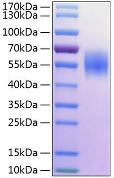 Recombinant Human MHC class I polypeptide-related sequence A/MIC-A Protein (RPCB0286)
