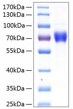 Recombinant Human IL-12A/IL-12 p35 Protein (RPCB0287)