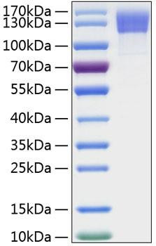 Recombinant Human OSMR/IL-31RB Protein (RPCB0300)