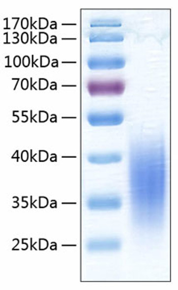 Recombinant Human B7-H5/Gi24/VISTA Protein (RPCB0351)