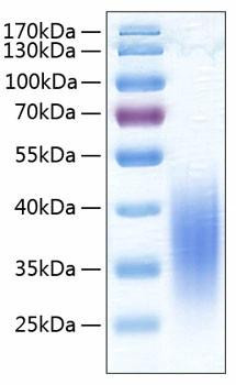 Recombinant Human B7-H5/Gi24/VISTA Protein (RPCB0351)