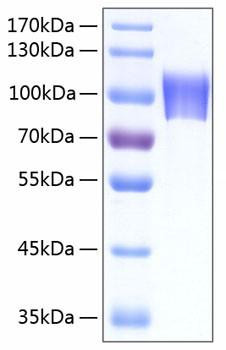 Recombinant Human Neuroligin-4/NLGN4X Protein (RPCB0365)