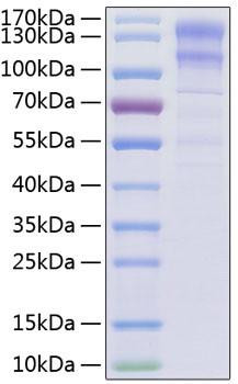 Recombinant Human Low-density lipoprotein receptor/LDLR Protein (RPCB0374)