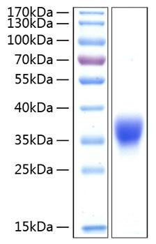 Recombinant Human BTN1A1/Butyrophilin Protein (RPCB0410)