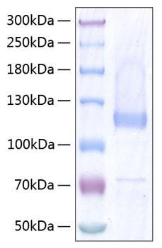 Recombinant Human Thrombospondin-5/COMP Protein (RPCB0447)