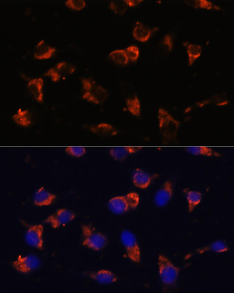 Anti-CA19-9 Mouse Monoclonal Antibody (CAB17437)