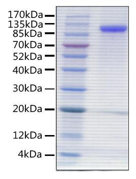 Recombinant Human Siglec-4a/MAG Protein (RPCB0497)
