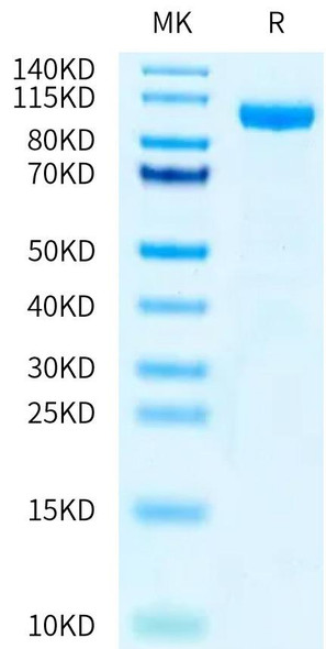 Recombinant Human IL-12 R beta 1/CD212 Protein (RPCB0518)