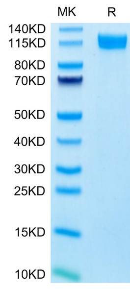 Recombinant Human E-Selectin/SELE/CD62E Protein (RPCB0526)