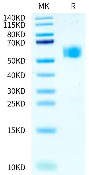 Recombinant Human IL-1R1/CD121a Protein (RPCB0530)