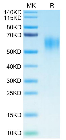 Recombinant Human IL-15RA/CD215 Protein (RPCB0596)