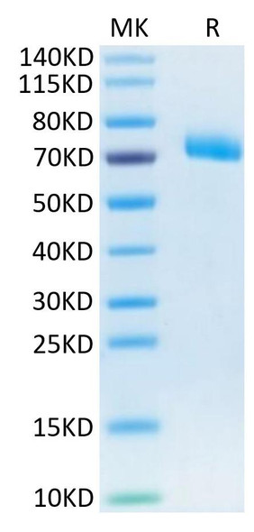Recombinant Human IL-12 R beta 1/CD212 Protein (RPCB0599)