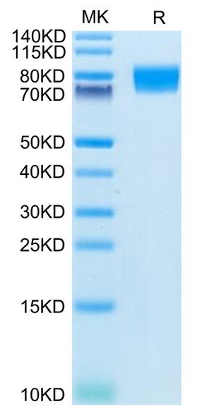 Recombinant Human c-Kit/CD117 Protein (RPCB0600)
