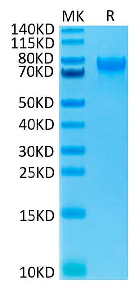 Recombinant Human IL-15RA/CD215 Protein (RPCB0610)