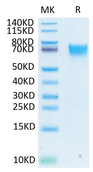 Biotinylated Recombinant Human FGFR-3 alpha (IIIb)/CD333 Protein (RPCB0613)